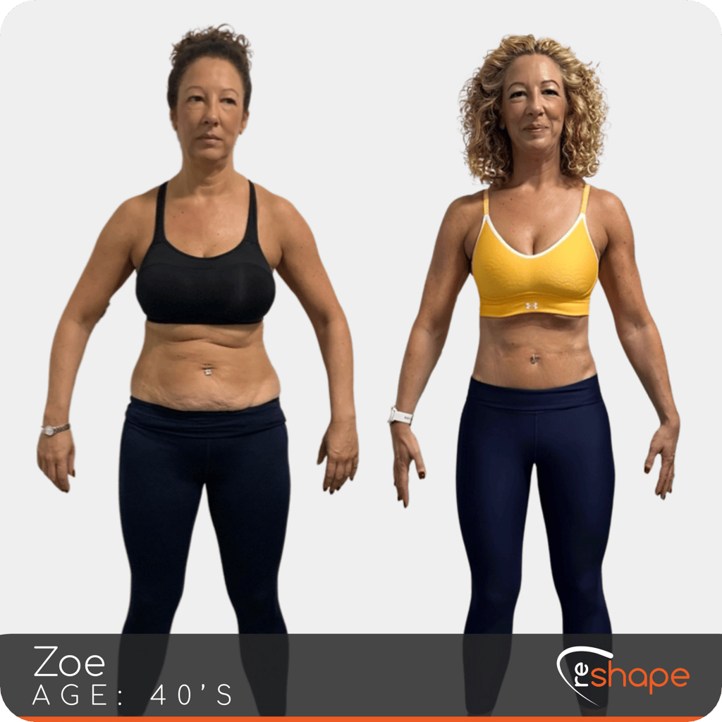 Transformation Photo