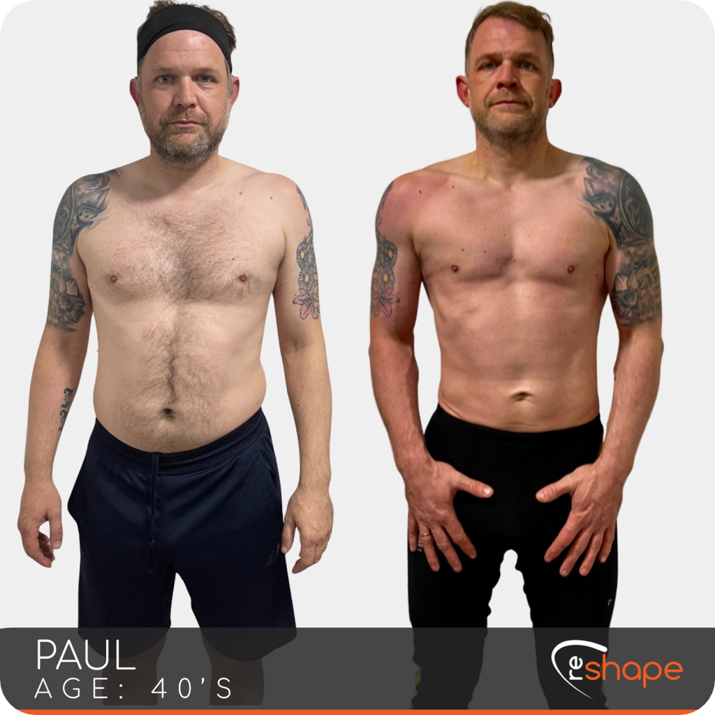 Transformation Photo