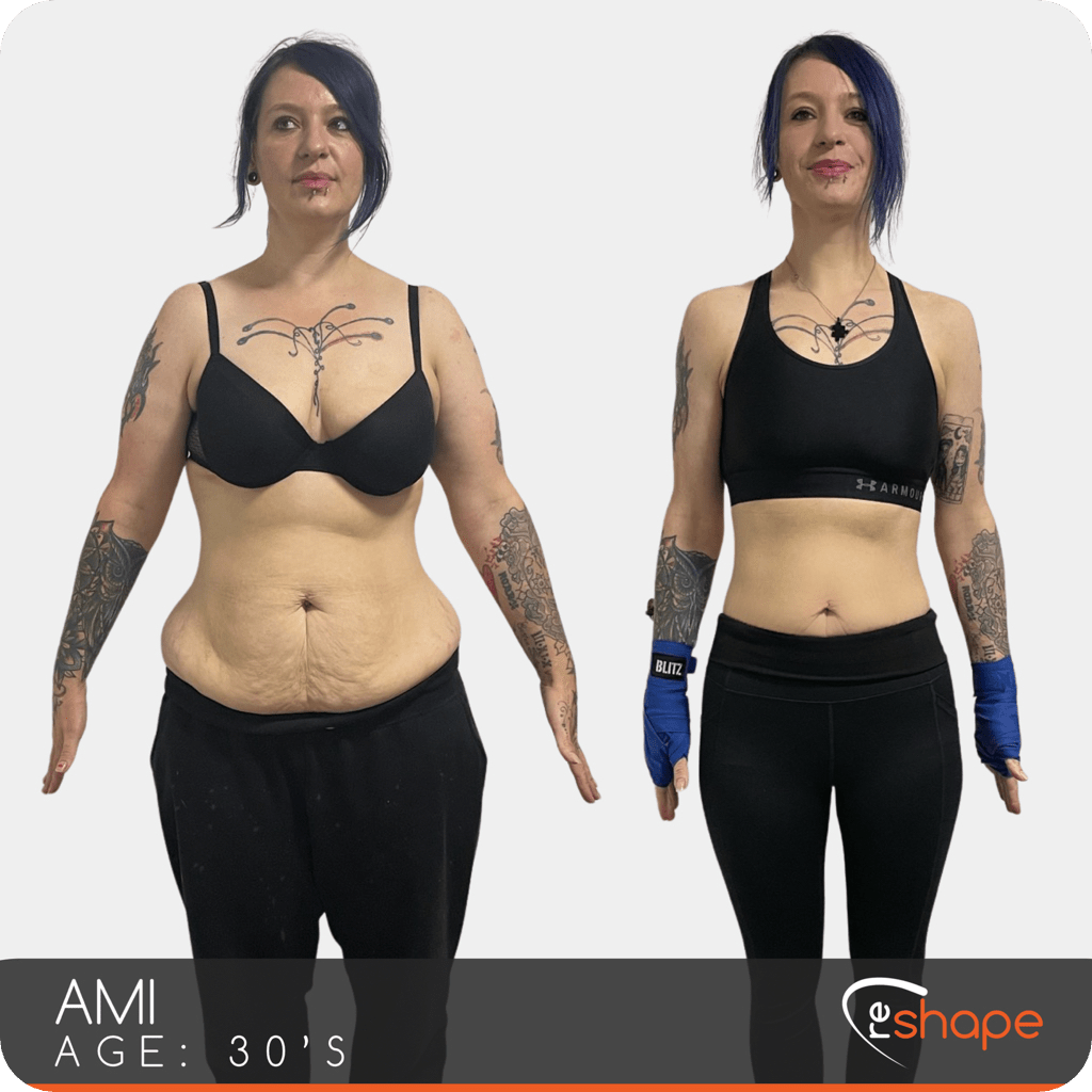 Transformation Photo