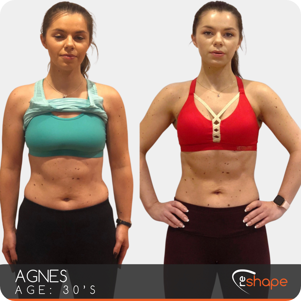 Transformation Photo