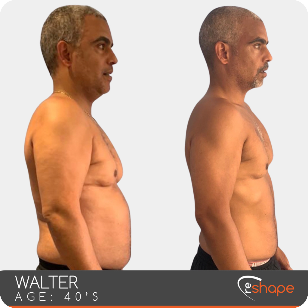 Transformation Photo