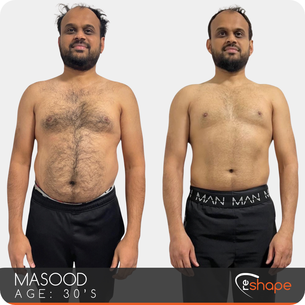 Transformation Photo