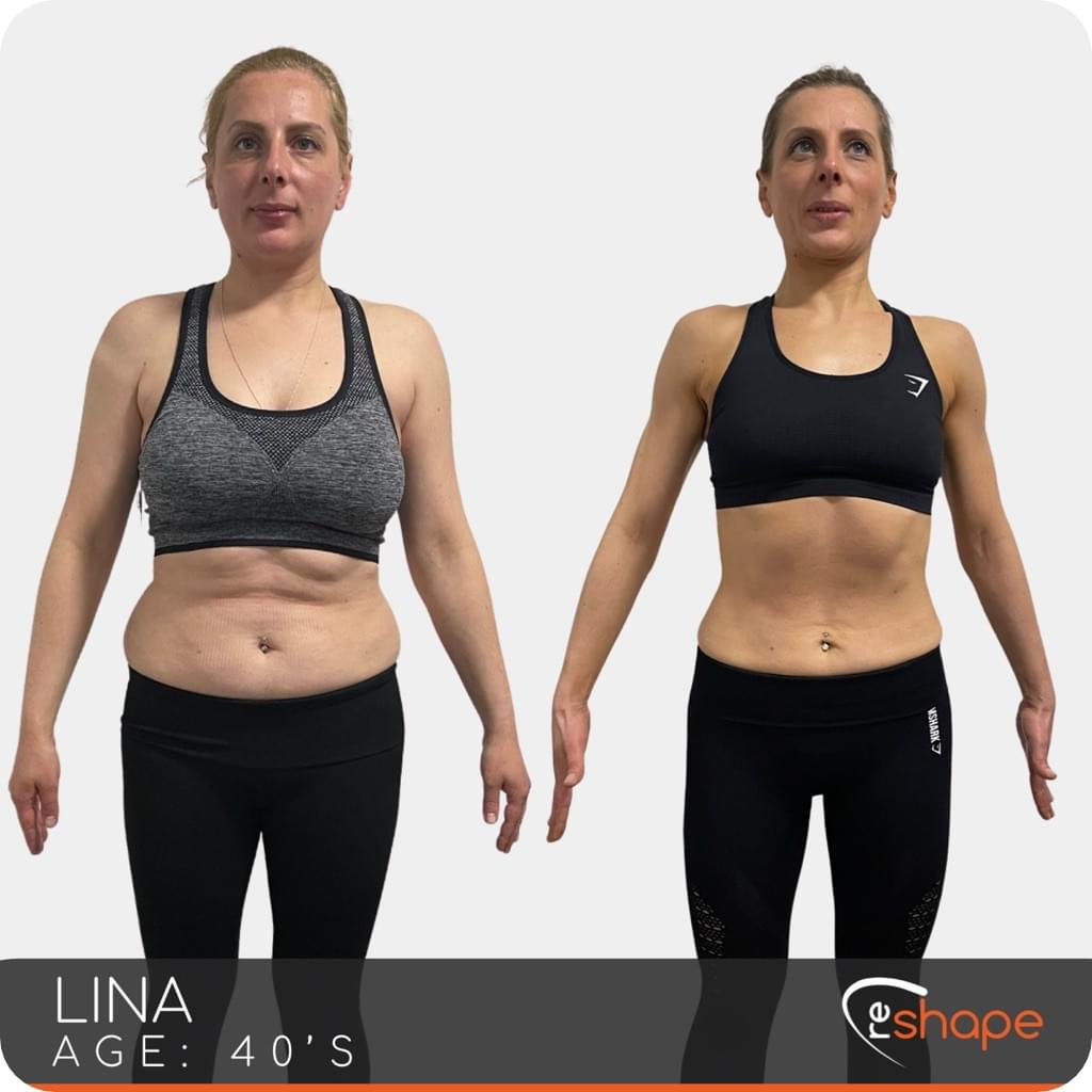 Transformation Photo