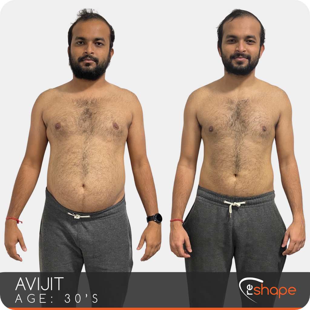 Transformation Photo