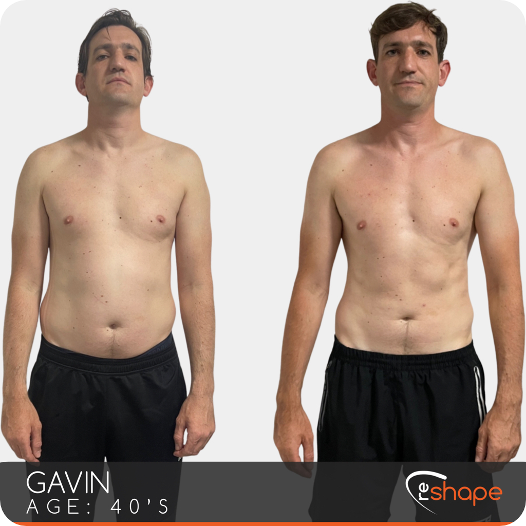 Transformation Photo