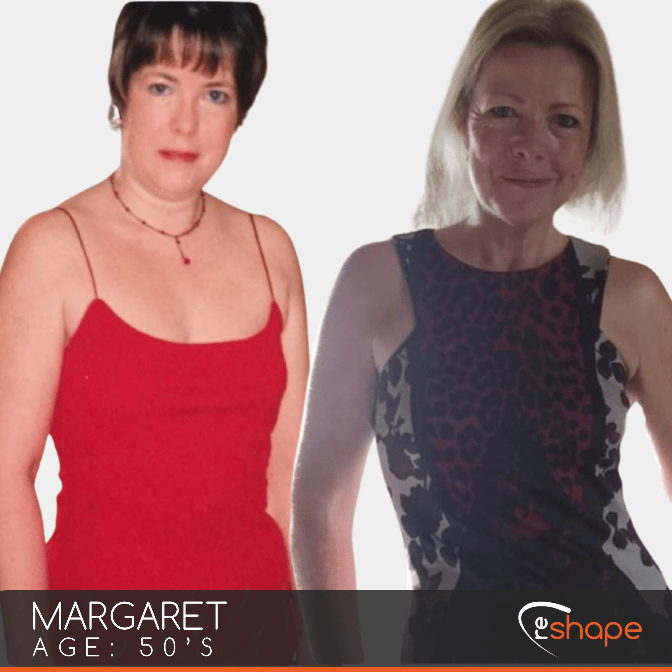 Transformation Photo